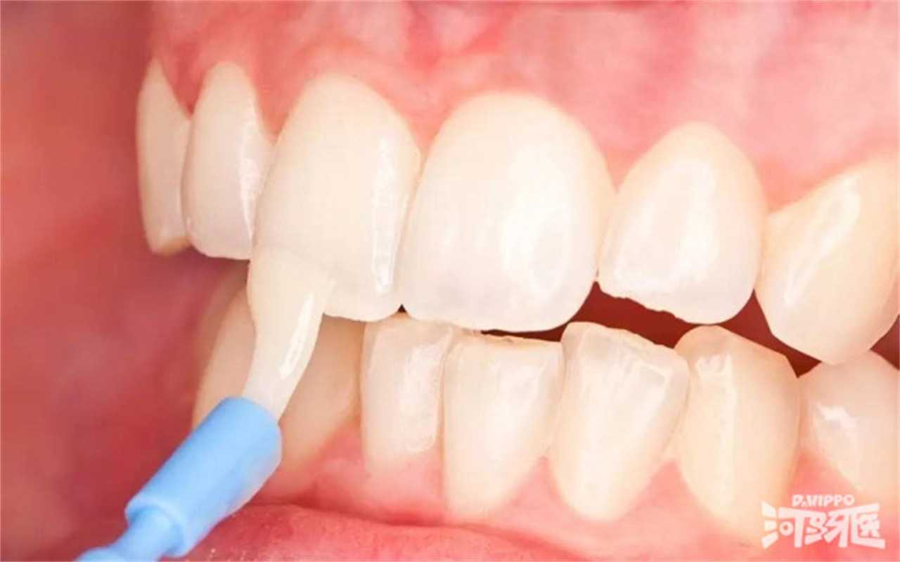 正常成年人的牙齿数量为(0至6岁儿童牙齿对照表)